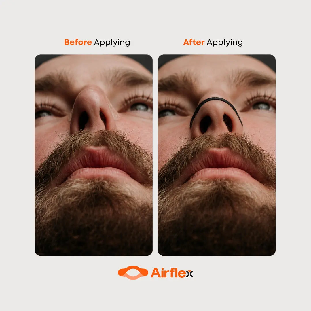 Airflex Nasal Strips – Saver Pack (30 Strips)