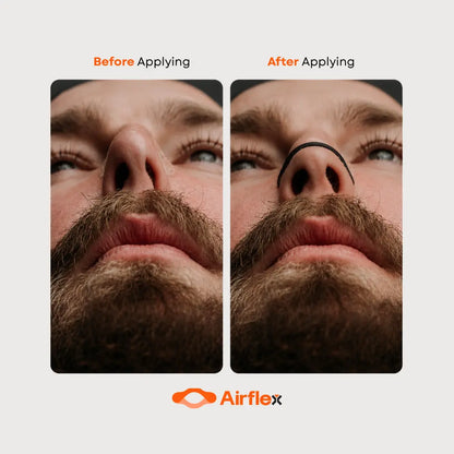 Airflex Nasal Strips – Saver Pack (30 Strips)